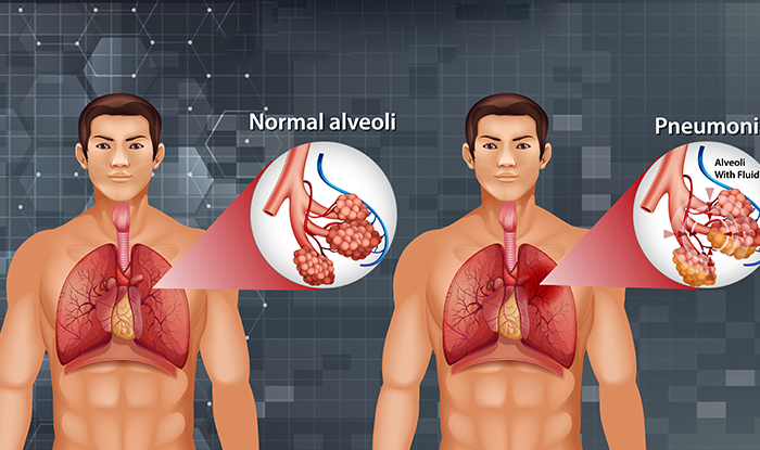 vascular-intervention-radiology