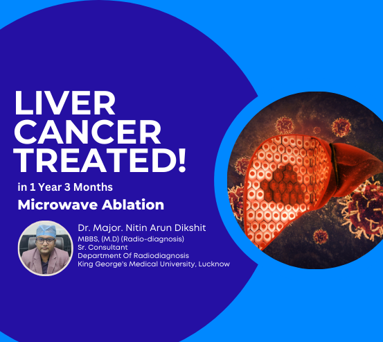 treating-liver-cancer-with-microwave-ablation